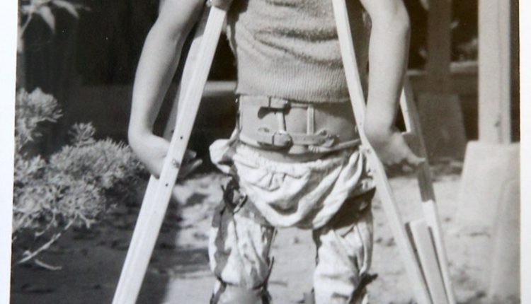 5歲時的任文倩因罹患小兒麻痺症，必須穿戴矯正固定器，拄著拐杖行走。（任文倩提供）